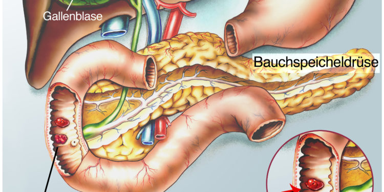 Seite unterm schmerzen rechte bauch Organe unter