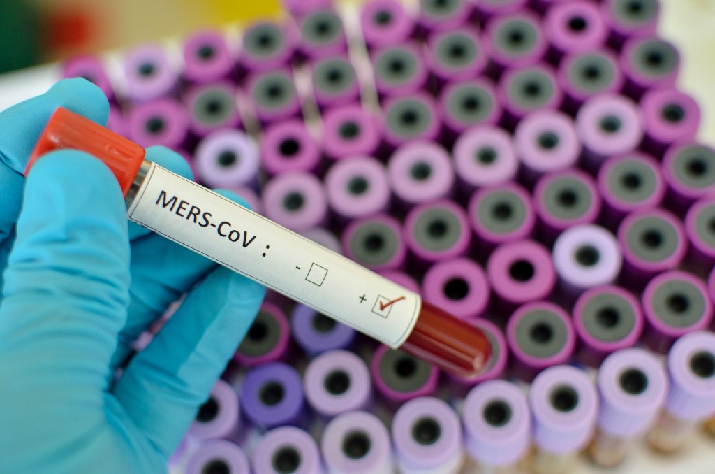 MERS-CoV positive