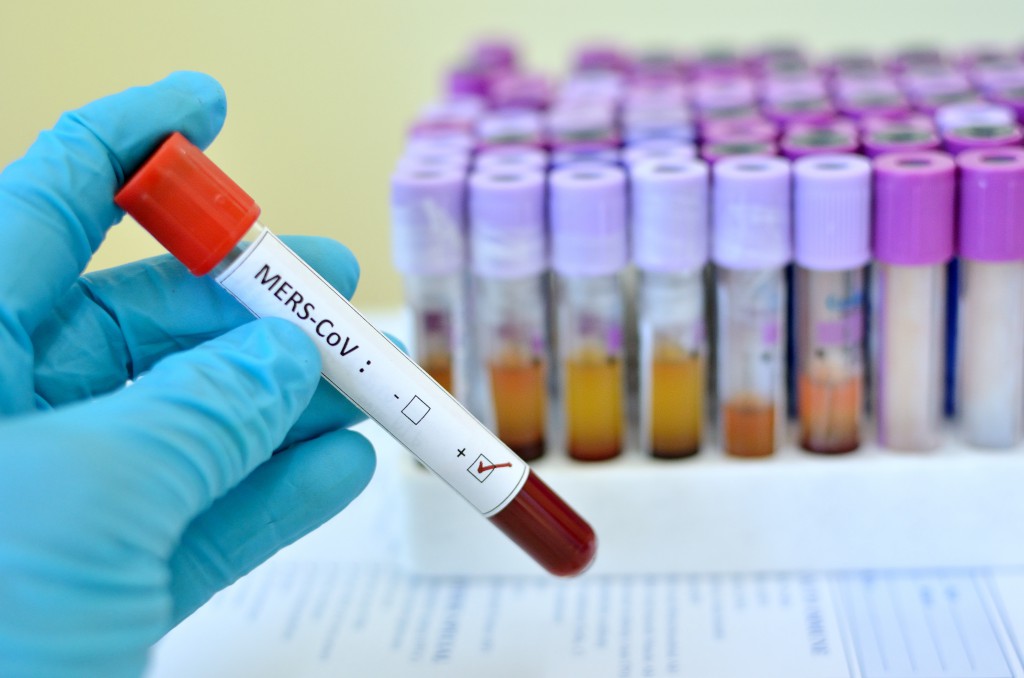 Blood sample with MERS-CoV (Middle East respiratory syndrome coronavirus) positive