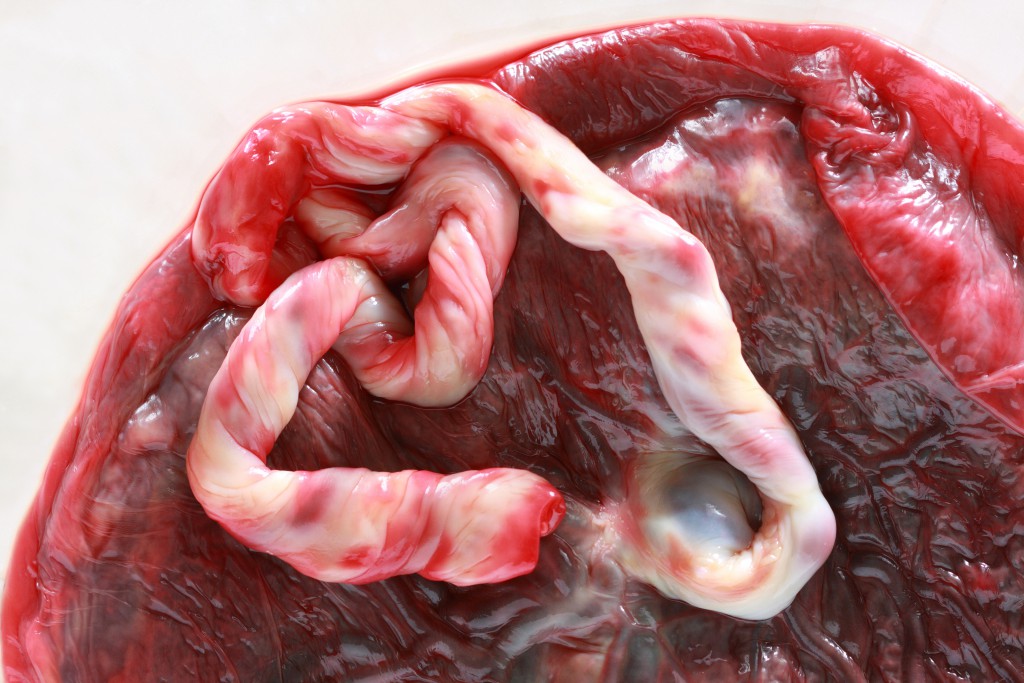 Close up of a fresh human placenta