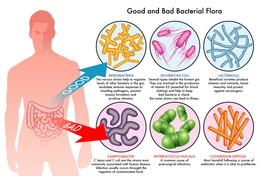 buona e cattiva flora batterica intestinale