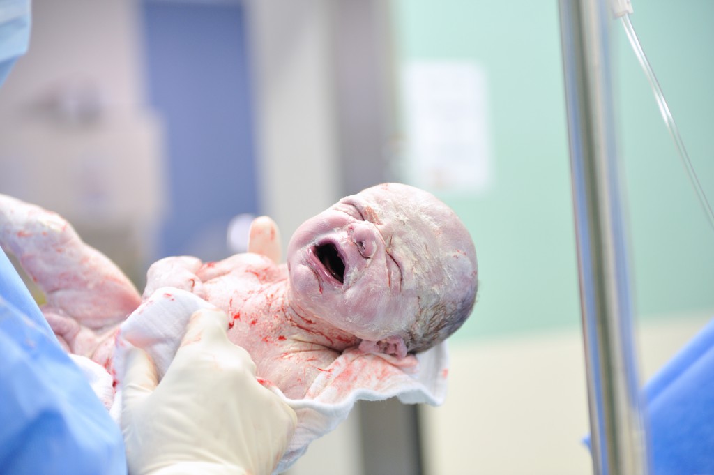 Begleitete Kaiserschnitt-Geburt: Die Mutter holte ihr Baby selbst aus dem Bauch. Bild: GordonGrand/fotolia