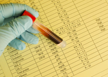 Eine Untersuchung der Blutwerte gibt Aufschluss über möglicherweise erhöhtes HDL- und LDL-Cholesterin. (Bild: jarun011/stock.adobe.com