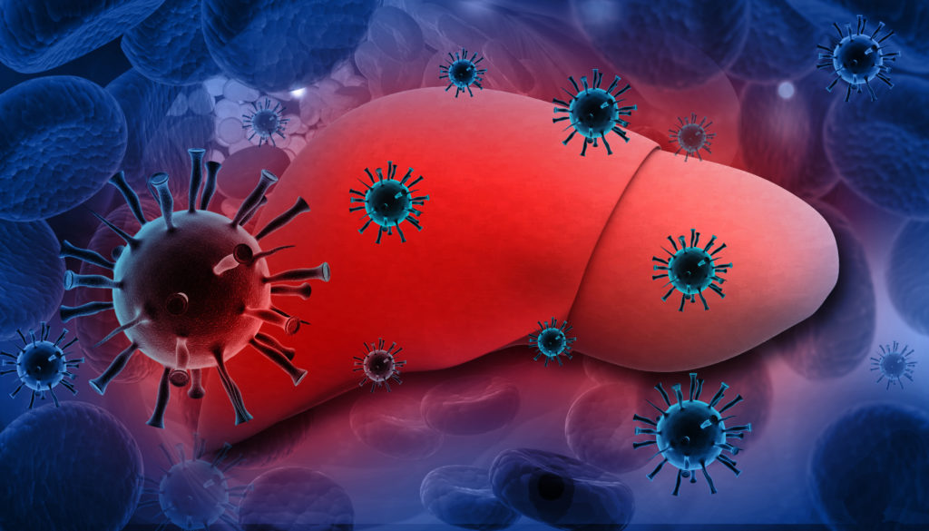 Infektionen der Leber mit Hepatitis-E-Viren können lebensbedrohliche Folgen haben. (Bild: bluebay2014/fotolia.com)