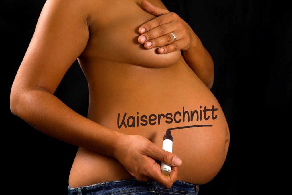 Immer mehr Frauen wollen einen Kaiserschnitt. (Bild: VRD - fotolia)