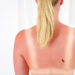 Das Risiko beim Sonnenbaden wird maßgeblich durch den jeweiligen Hauttyp bestimmt. (Bild: Dan Race/fotolia.com)