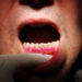 Zahnfleischbluten und Mundgeruch kann auf (Bild: Eric Fahrner/fotolia.com)