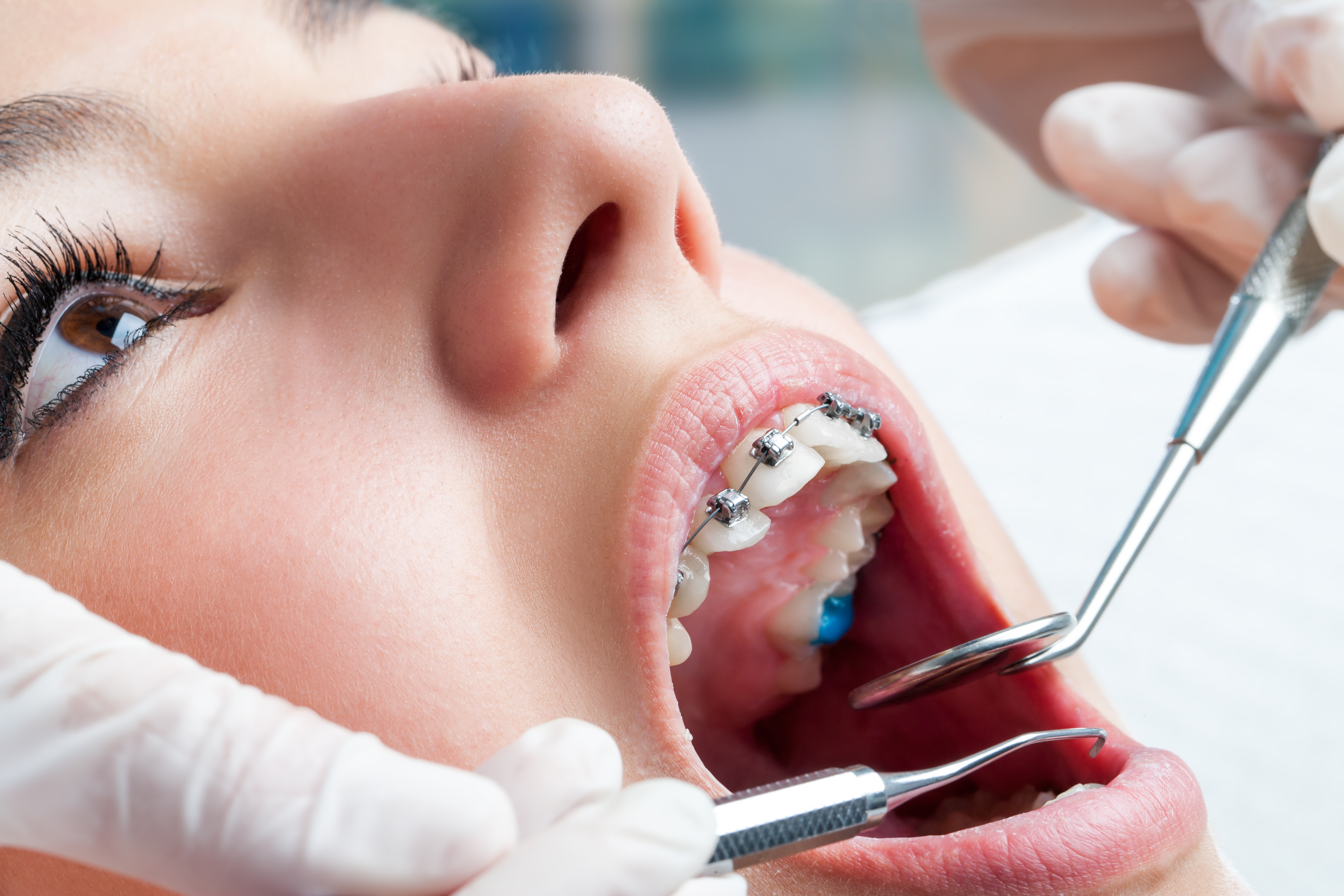 Ортодонтия что это. Ортодонтия в стоматологии. Стоматология ортодонт. Оптидант в стоматологии.