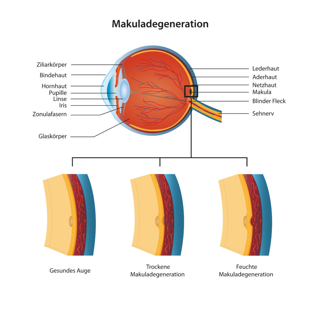 Altersbedingte Makuladegenration könnte in Zukunft heilbar sein. (Bild: bilderzwerg/fotolia.com)