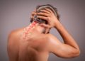Degenerative Veränderungne könnne zu massiven Schmerzen im Kopf- und Nackenschmerzen führen.  (Bild: artstudio_pro/fotolia.com)