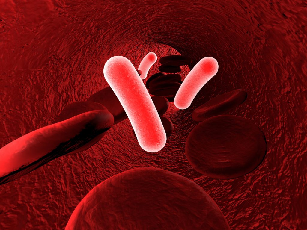 Tödliche Sepsis: Eine schnelle Behandlung ist das A und O. Bild: Dr_Kateryna -fotolia