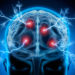 Entzündungen im Gehirn möglicher Auslöser für Schizophrenie und Psychosen. (Bild: psdesign1/fotolia.com)