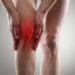 Urteil: Verletztenrente auch bei einseitiger Arthrose. Bild: Stasique - fotolia