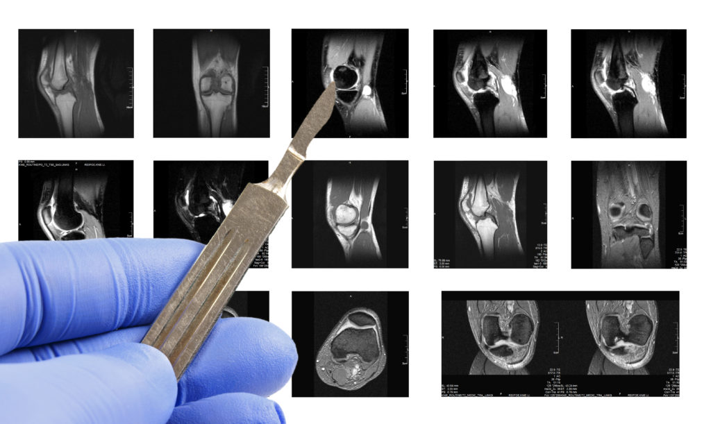 Tausende Patienten warten auf eine OP. Bild: PhotographyByMK - fotolia