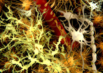 Die Vorläuferproteine der gefürchteten Plaques führen bereits zu veränderter Neurotransmitter-Aktivität. (Bild: Juan Gärtner/fotolia.com)