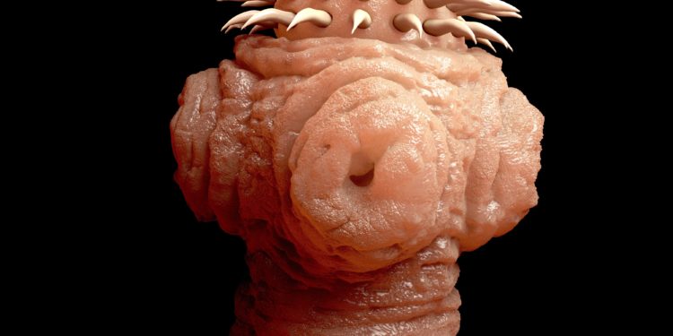 Bandwurm Bandwurmer Anzeichen Und Symptome Heilpraxis