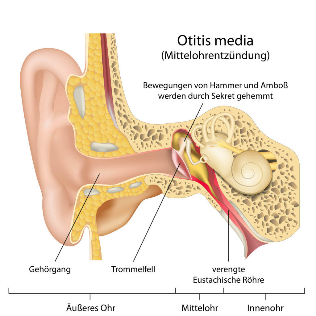 Bei einer Mittelohentzündung sind oftmals starke Ohrenschmerzen und Beeinträchtigungen des Hörvermögens festzustellen. (Bild: bilderzwerg/fotolia.com)