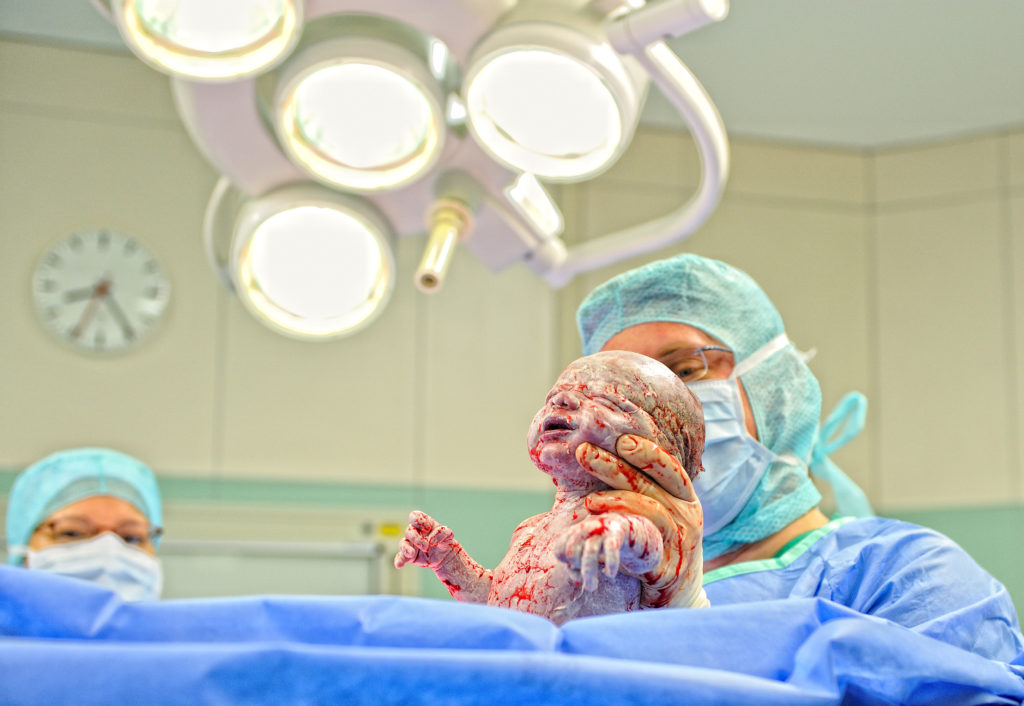 Komplikationen bei der Geburt können leicht das Leben der Mutter gefährden, wenn die medizinische Versorgung nicht angemessen ist. (Bild: GordonGrand/fotolia.com)