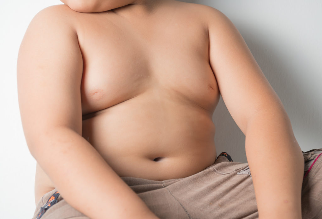 Wie dicke Kinder auch dünn werden können. Bild: kwanchaichaiudom - fotolia