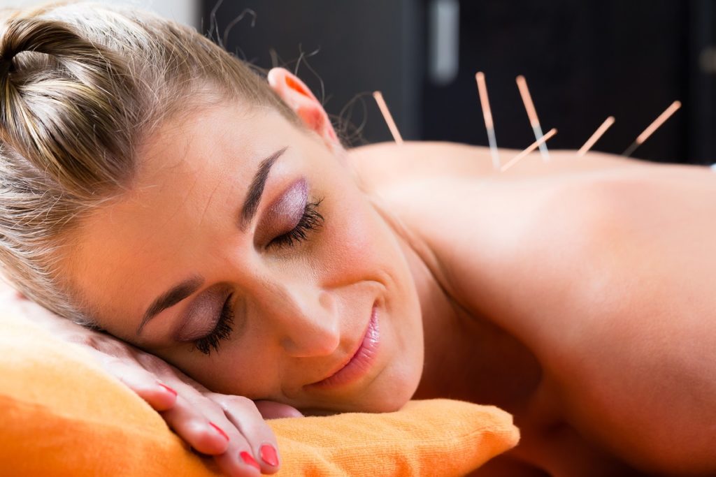 Laut einer aktuellen Studie kann Akupunktur Nackenbeschwerden lindern. Bild: Kzenon - fotolia