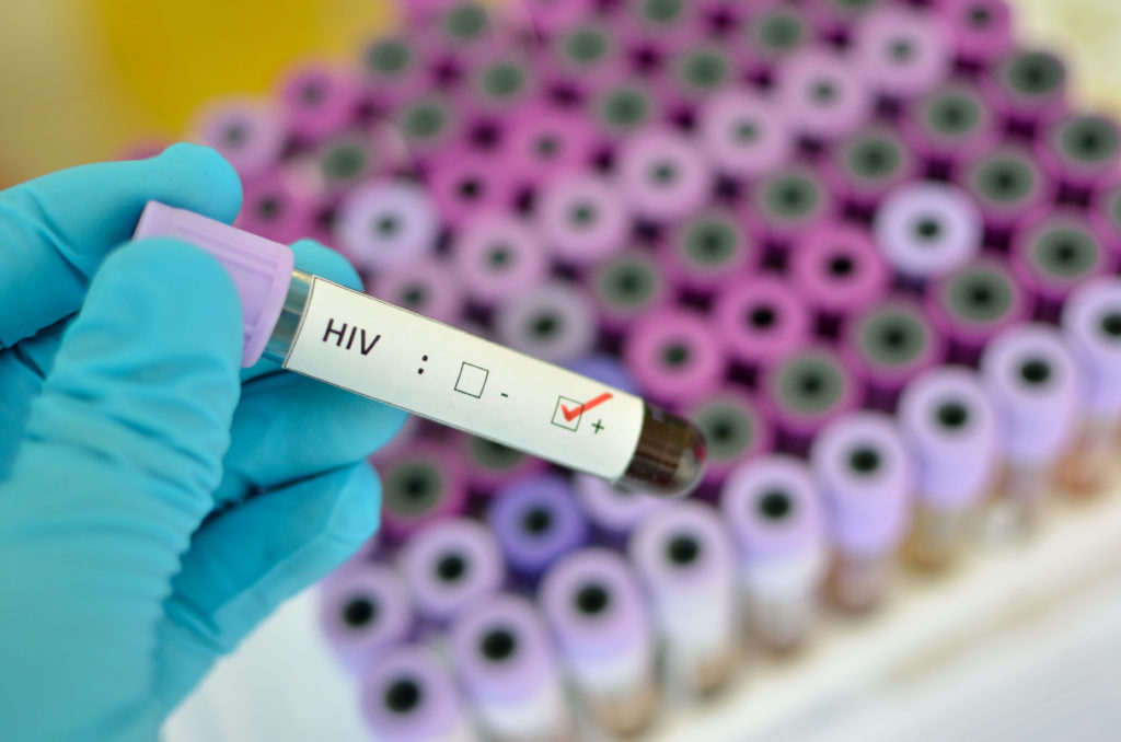 Hiv-Neuinfektionen weiterhin konstant. Bild: jarun011 - fotolia