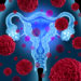 Die tödlichen Verläufe bei Eierstockkrebs lassen sich möglicherweise durch einen Screening-Bluttest reduzieren. (Bild: freshidea/fotolia.com)