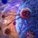 Der aktuelle Krebs-Report des RKI zeigt eine Stagnation der Krebsneuerkrankungen. (Bild: vitanovski/fotolia.com)