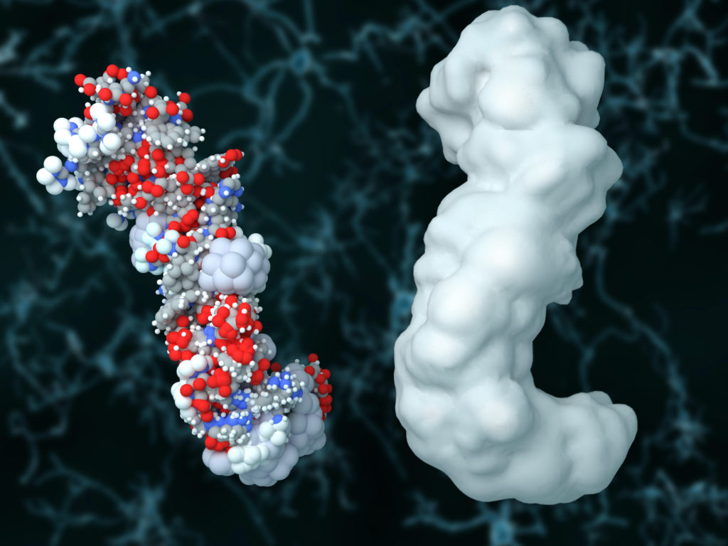 Proteinablagerungen können den Nervenzellen schaden und zu neurodegenerativen Erkrankungen führen. (Bild: Juan Gärtner/fotolia.com)