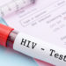 Zunahme der HIV-Infektionen. Bild: gamjai - fotolia