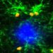Die Entzündungsprozesse im Gehirn (grün erkennbare Mikrogliazellen) sind maßgeblich an der Entwicklung von Alzheimer beteiligt. (Bild: University of Southampton)