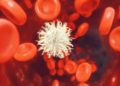Eine Krebszelle zwischen roten Blutkörperchen