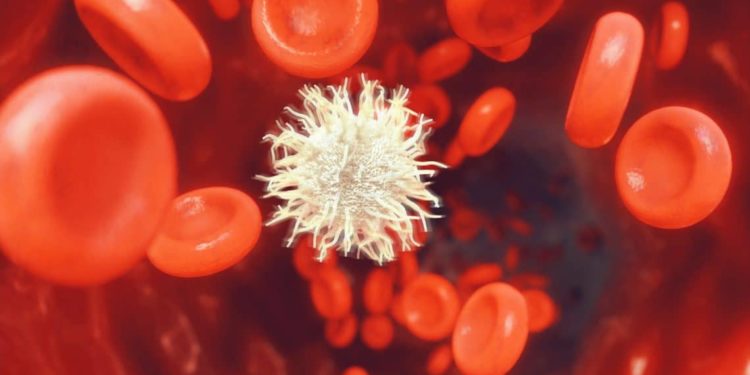 Eine Krebszelle zwischen roten Blutkörperchen