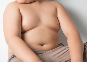 Weltweit leiden laut Angaben der WHO immer mehr Kinder unter Übergewicht. (Bild: kwanchaichaiudom/fotolia.com)