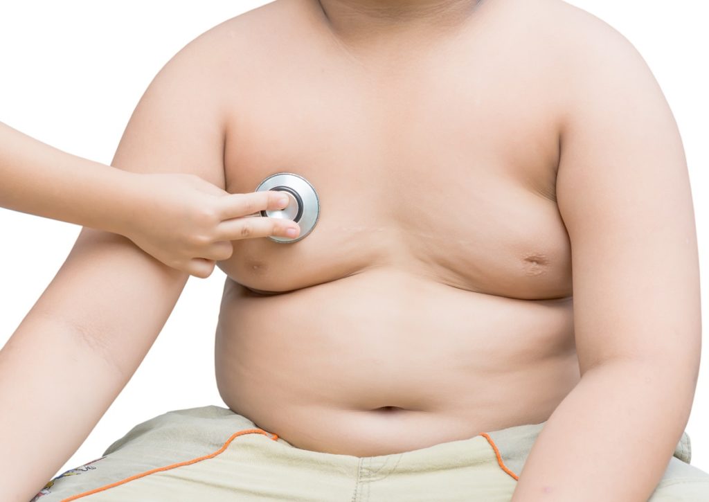 Immer mehr Kinder sind weltweit übergewichtig. Bild: kwanchaichaiudom - fotolia