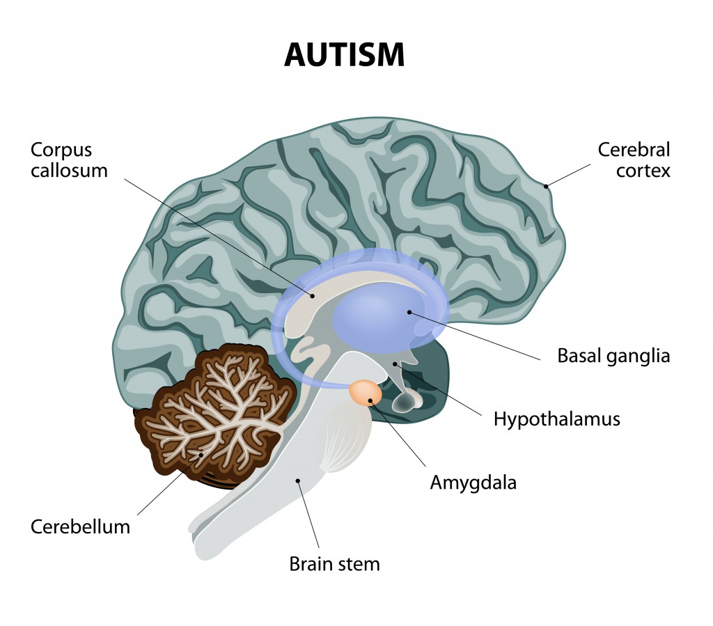 Autisten zeigen eine veränderte Verarbeitung der Informationen im Gehirn, was mit kongnitiven un sozialen Einschränkungen aber auch mit besonderen Fähigkeiten verbunden sein kann. (Bild: designua/fotolia.com)