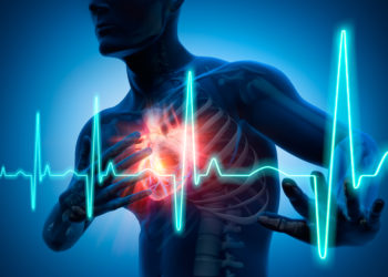 Deutsche Forscher haben neue Erkenntnisse über den Zusammenhang von Herzschwäche, gefährlichen Herzrhythmusstörungen und einer gestörten Kalziumversorgung im Herzen gewonnen. (Bild: psdesign1/fotolia.com)