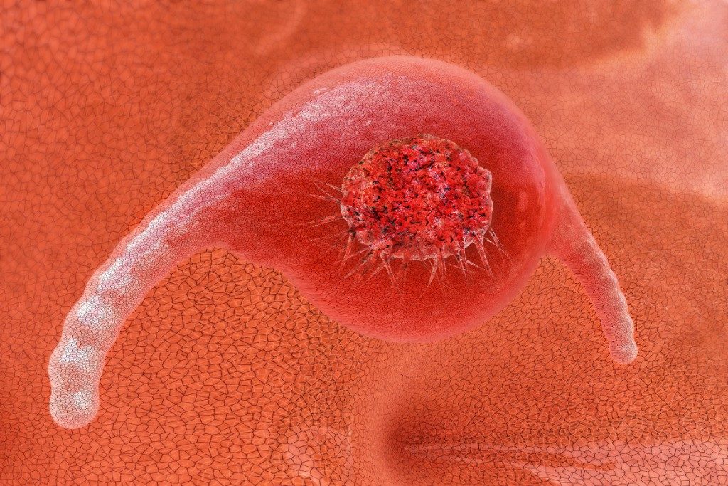 Krebszellen einer bereits verstorbenen Patientin teilen sich bis heute. Bild: fotoliaxrender - fotolia