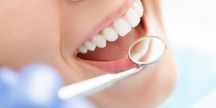 Gute Zahnpflege So Werden Zahne Wieder Weisser Heilpraxis