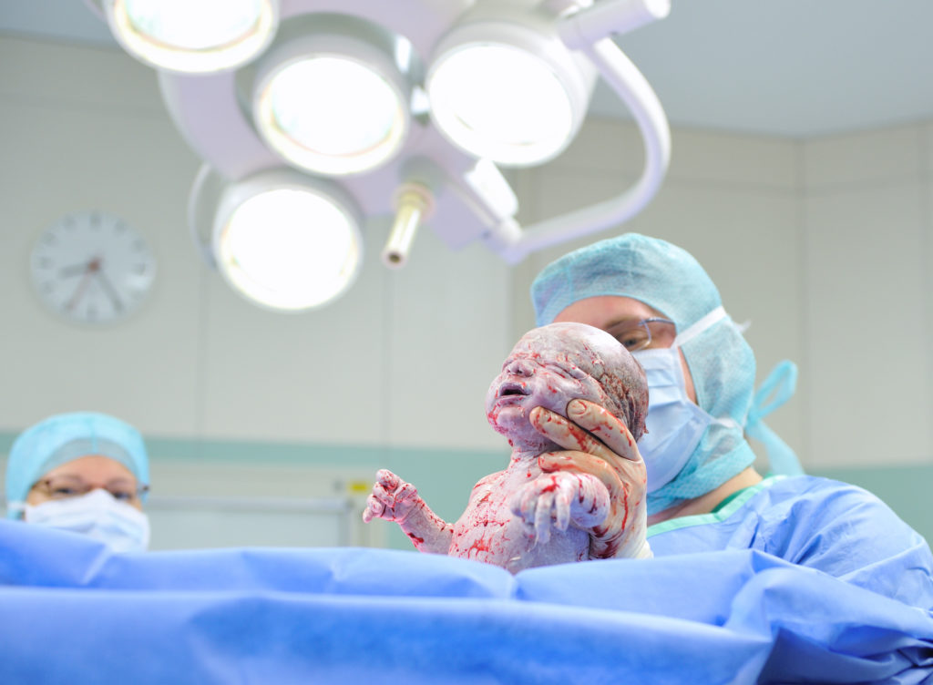 Kaisernschnitte werden von den Kliniken immer häufiger als Not-Operationen abgerechnet, vermutlich aus wirtschaftlichen Gründen. (Bild: GordonGrand/fotolia.com)