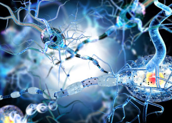 Durch spezielle Pflanzenpetide lässt sich die Zerstörung der Nervenfasern bei MS möglicherweise stoppen. (Bild: ralwel/fotolia.com)