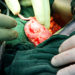 Revolutionäre Methode ermöglicht es Patienten, eine transplantierte Niere von einem eigentlich inkompatiblen Spender zu erhalten.(Bild:
    horizont21/Fotolia.com)