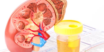 Werden nur 500 Milliliter Urin am Tag abgegeben, ist in der Fachwelt von einer Oliguire die Rede, welche im Zusammenhang mit schweren Nierenerkranungen stehen kann. (Bild: tomschoumakers/fotolia.com)