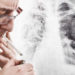 Auch nach dem Rauchstopp ein erhöhtes Lungenkrebsrisiko. Bild: © igor - fotolia