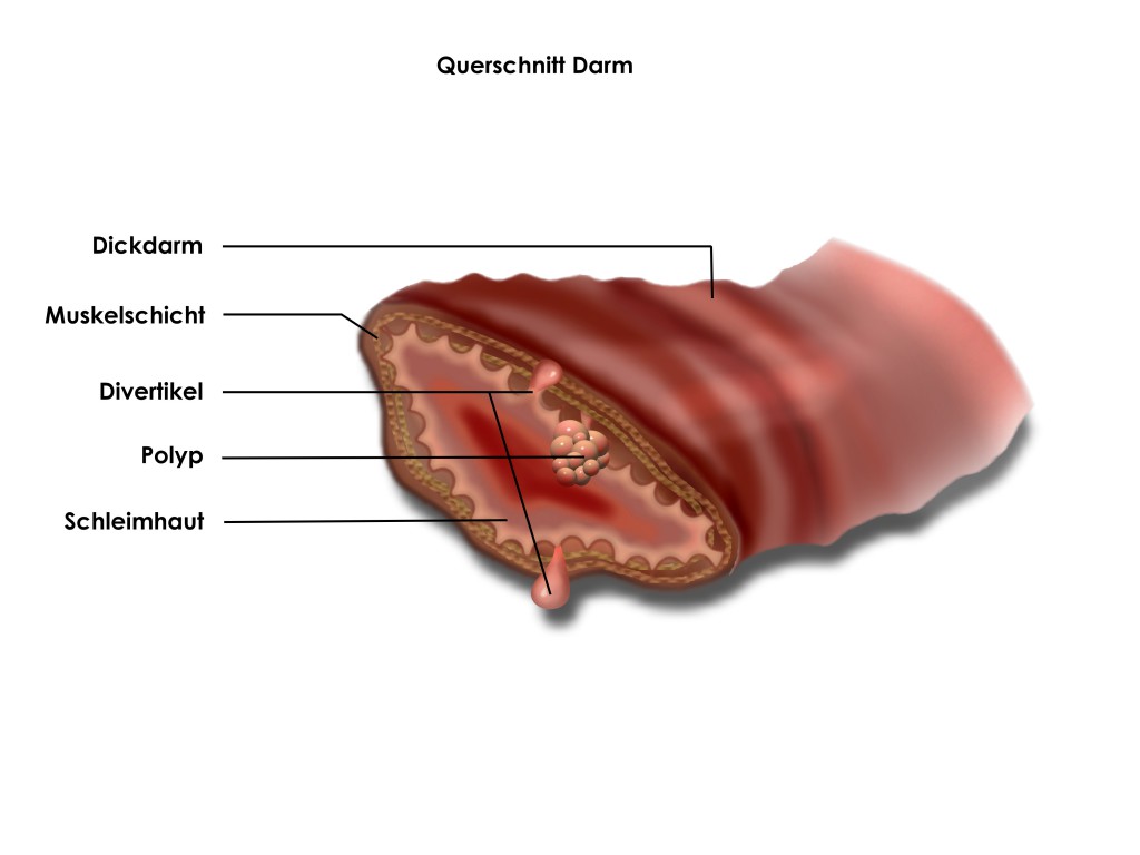 Blut am After - Heilpraxis 