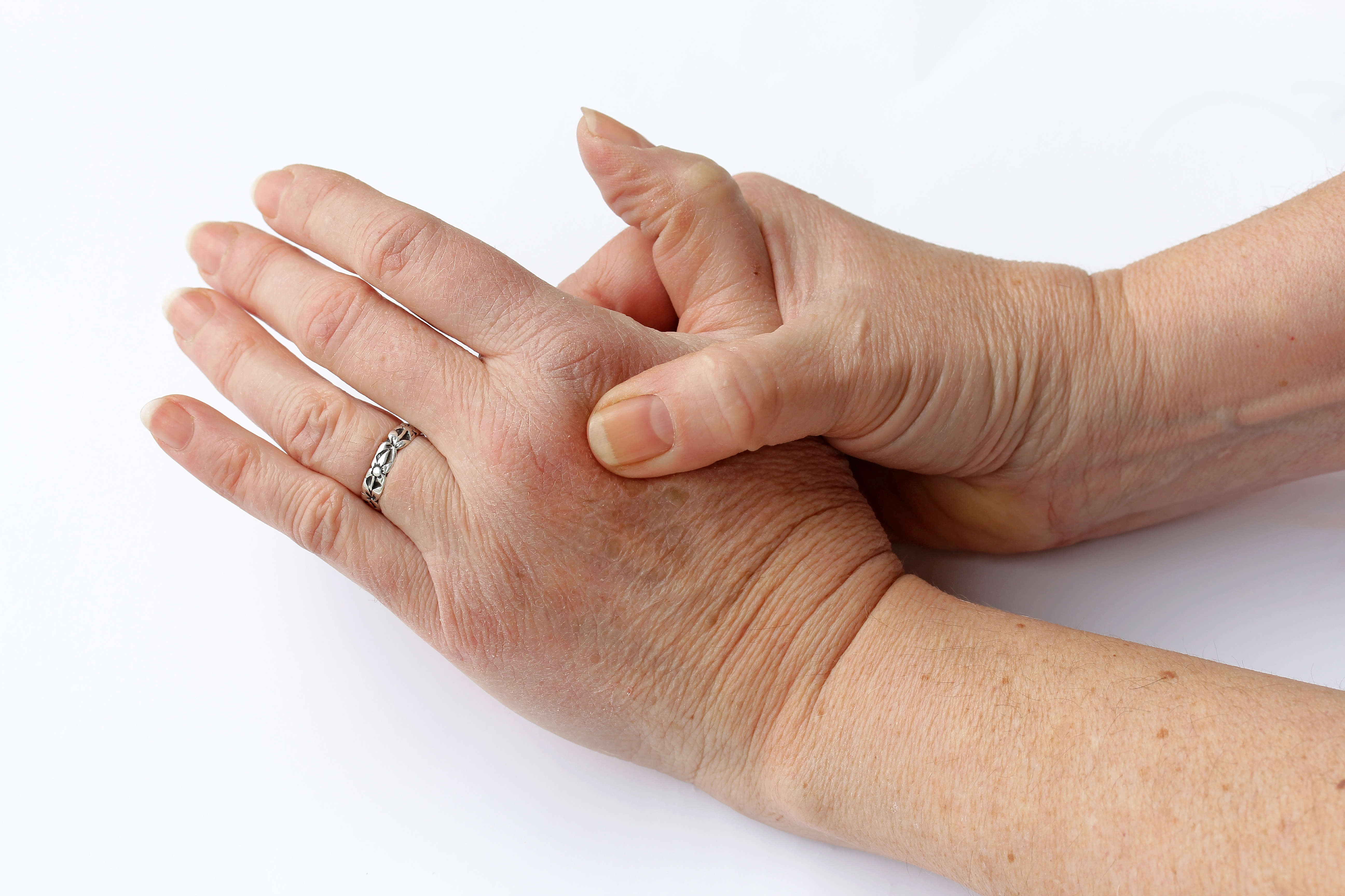 Gesundheit: Verursacht ständiges Fingerknacken wirklich Arthrose? 
