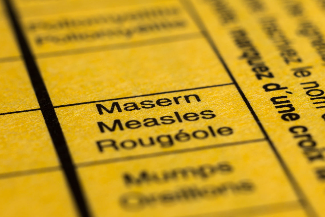 Infektionskrankheit soll eliminiert werden Schon gegen Masern geimpft? Heilpraxis Infektionskrankheit soll eliminiert werden Schon gegen Masern geimpft? Heilpraxis