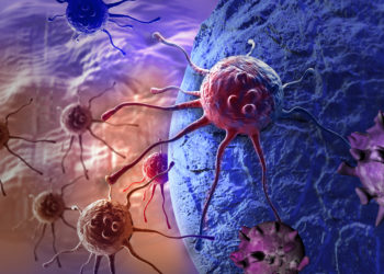 Krebszellen bewirken meiste eine deutliche Änderung des Oxidationszustandes im Organismus. (Bild: vitanovski/fotolia.com)