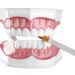Raucher erkranken besonders oft an Parodontitis und müssen daher verstärkt auf richtiges Zähneputzen achten. (Bild: diyes/fotolia.com)
