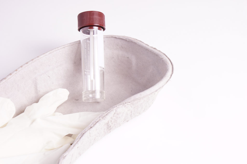 Der immunologische Stuhltest ist künftig als Teil der Darmkrebs-Früherkennung vorgesehen. (Bild: esben468635/fotolia.com)