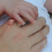 Die Existenz von mehr als fünf Fingern an einer Hand wird als Polydaktylie bezeichnet. In China kam nun ein Junge zur Welt, der insgesamt 31 Finger und Zehen hat. (Bild: annavee/fotolia.com)